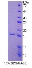 Recombinant Thrombomodulin (TM)