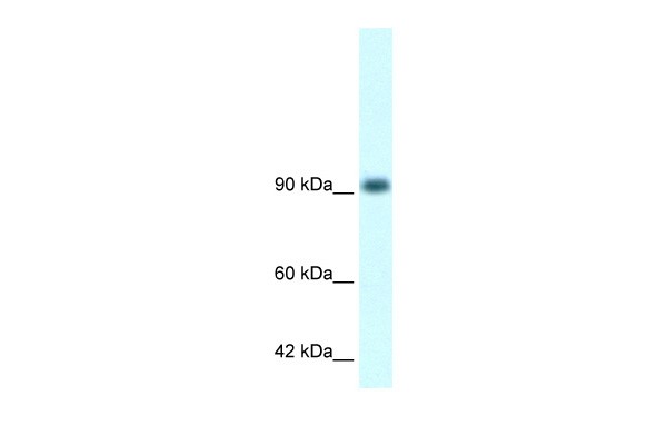 RBM10 antibody - N-terminal region