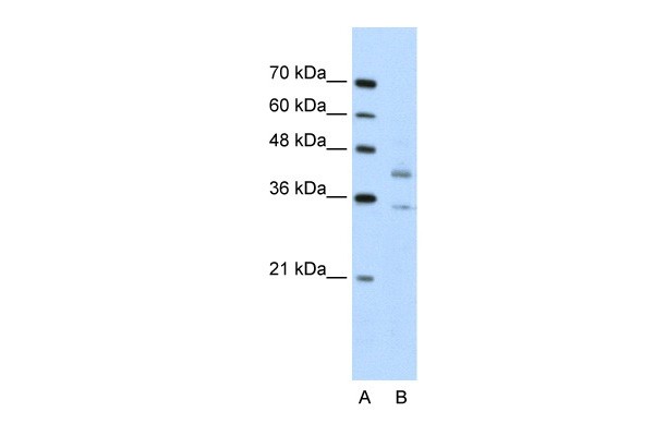 DFFA antibody