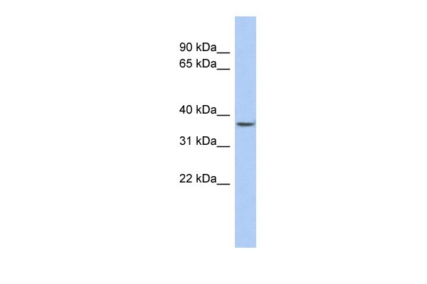 FOXE3  antibody - N-terminal region