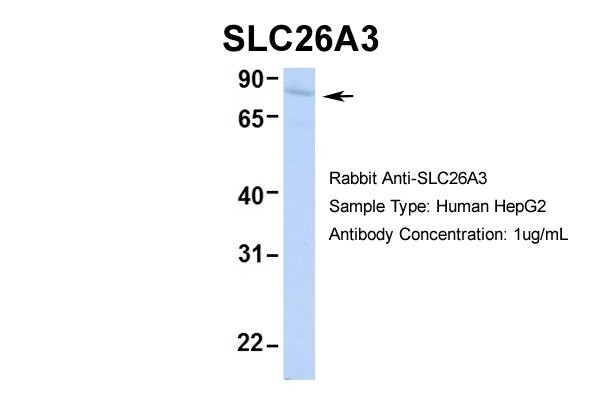 SLC26A3antibody - middle region