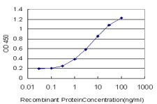 NCOA6IP Antibody (monoclonal) (M01)