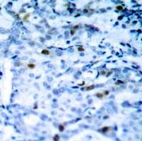 CDC2 (phospho Thr161) Antibody