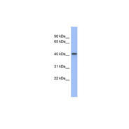 FIZ1 antibody
