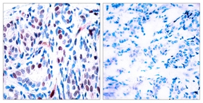 STAT3 (Phospho-Tyr705) antibody