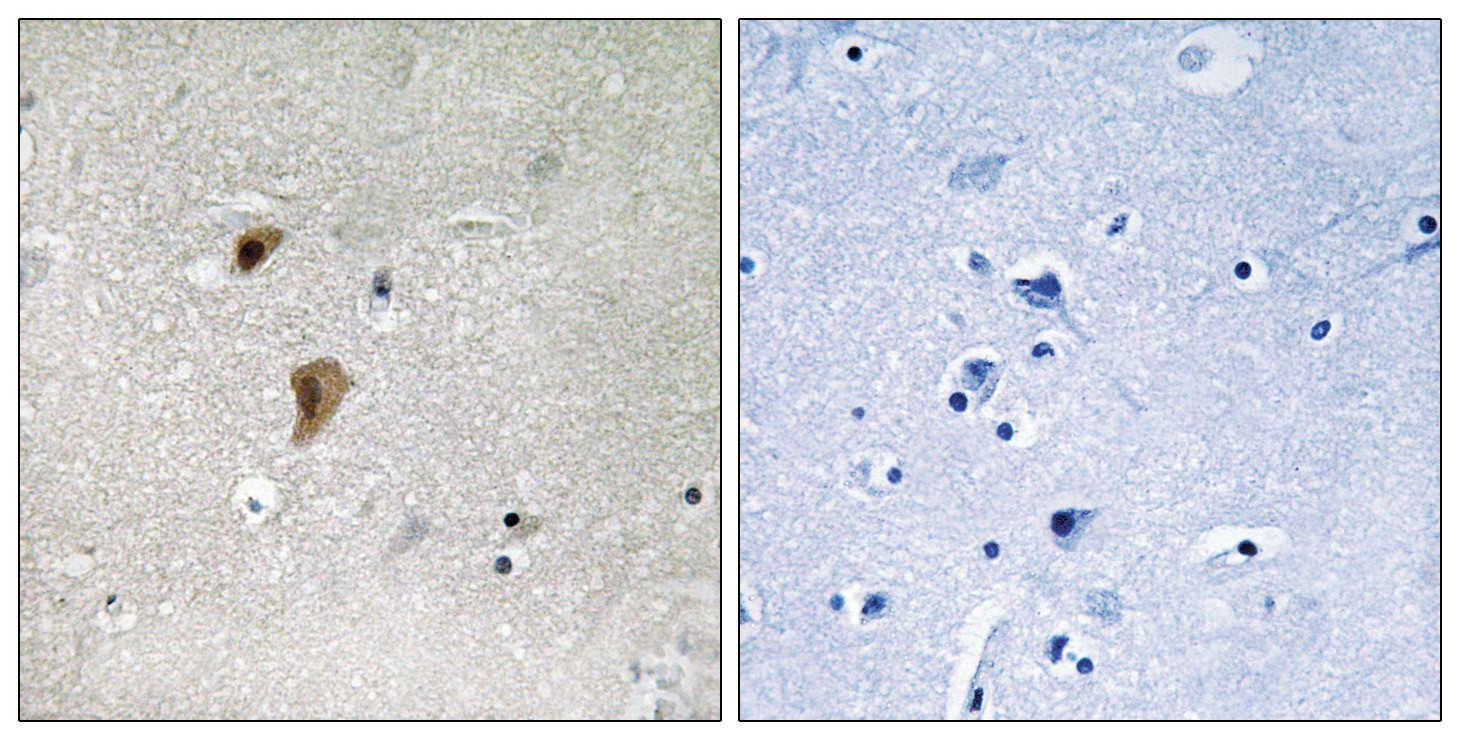 HSF1 (phospho Thr142) Antibody