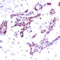 STAT1 (phospho Tyr701) Antibody