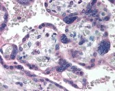 TP73 Antibody