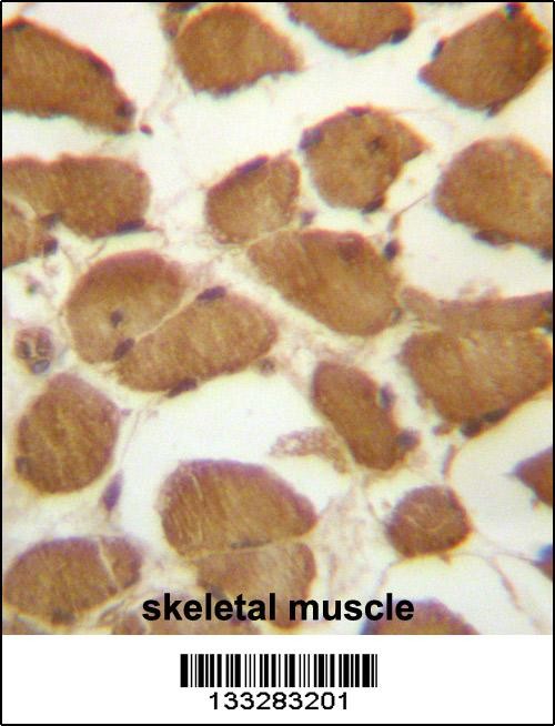 CDKN1B Antibody