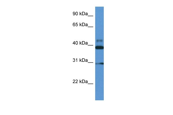 VASP antibody - middle region