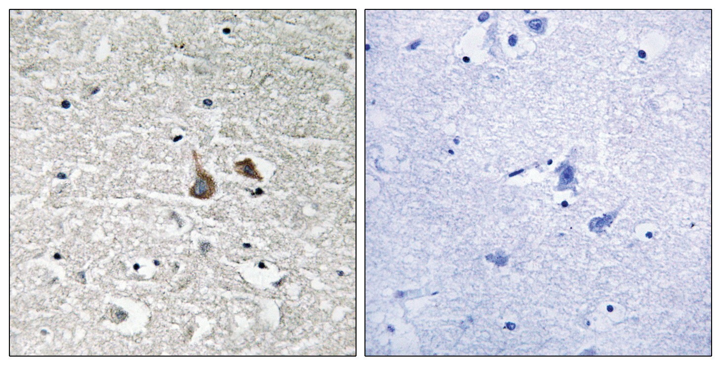 IRAK1 (phospho Ser376) Antibody