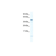 ZMAT1 antibody
