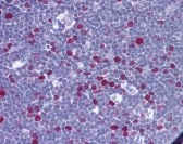 NPM1 AntibodyNucleophosmin Antibody