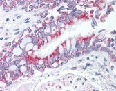 Phospholipase (phospho Ser58) A2 Antibody
