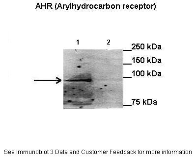 AHR antibody - N-terminal region