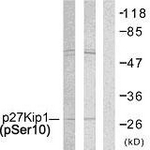 p27 Kip1 (Phospho-Ser10) antibody