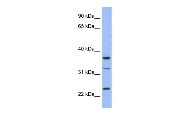 SOX21 antibody - middle region