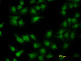 MGC13096 Antibody (monoclonal) (M01)
