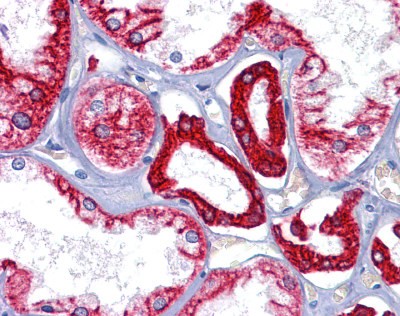 Cytoke Antibody