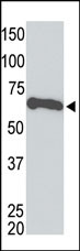 Myc Tag Antibody