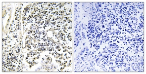 IkappaB-alpha (Phospho-Tyr305) antibody