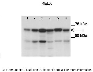 RELA antibody