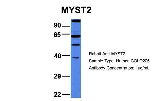 MYST2 antibody - N-terminal region