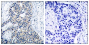 Stathmin 1 (Phospho-Ser37) antibody