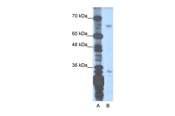 ZNF691 antibody - N-terminal region