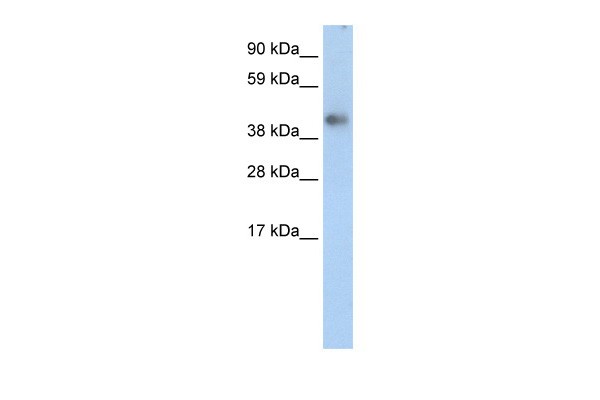 ZNF620 antibody - middle region