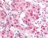E2F1 (phospho Ser364) Antibody