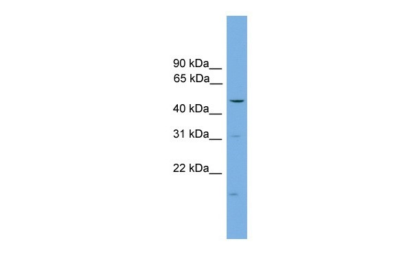 ARRB1 antibody