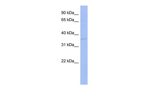 TLX3antibody - N-terminal region