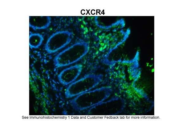 CXCR4 antibody - N-terminal region