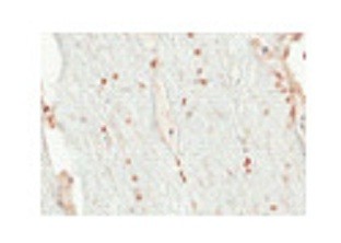 OLIG2 antibody