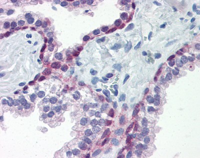 HSF1 Antibody
