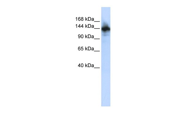 RBM6 antibody