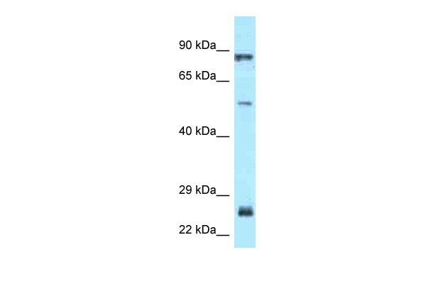 E2F1 antibody