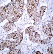 EGFR (phospho Tyr1092) Antibody