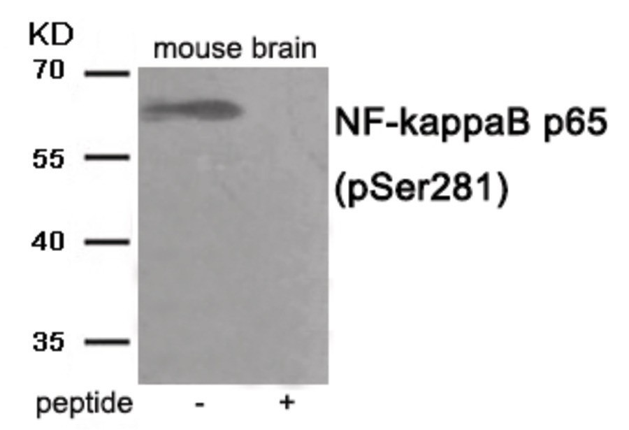 NF- kappaB p65 (phospho Ser281) Antibody
