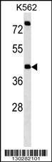 P2RX2 Antibody