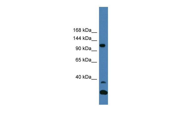 TYK2 antibody - C-terminal region