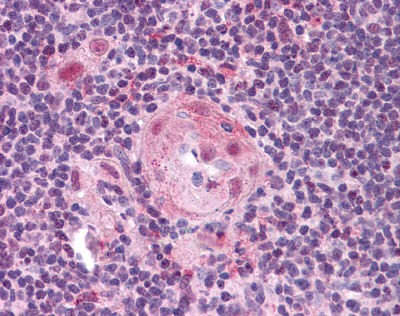 TLR2 antibody
