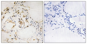 BCL-2 (Phospho-Ser87) antibody