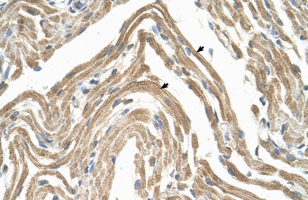 CCBP2 antibody