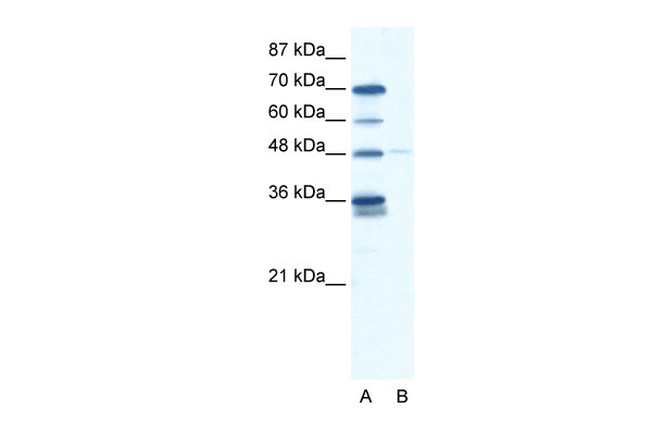 GLIS2 antibody - N-terminal region