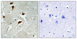 4E-BP1 (Phospho-Thr69) antibody