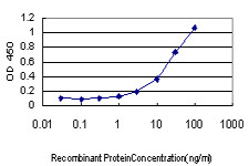 MUC5AC Antibody (monoclonal) (M07)