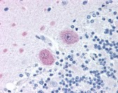Phospholipase A2 Antibody