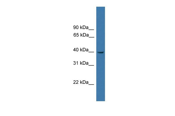 LTB4R antibody